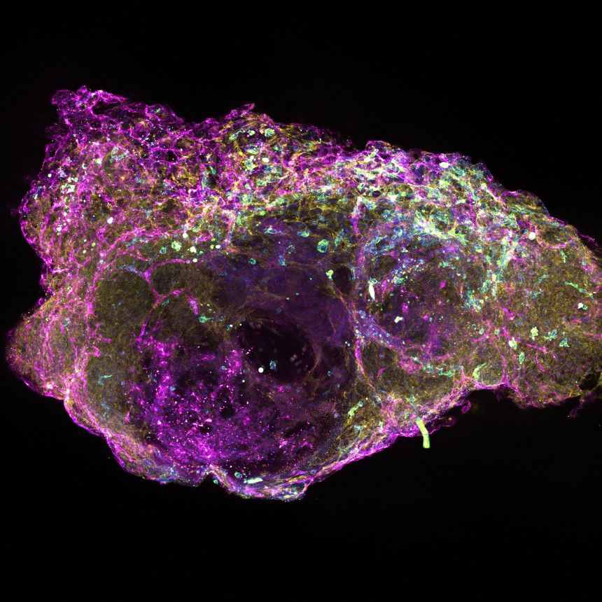 A cross section of a mini bone marrow organoids showing cells that produce blood platelets, in a network of blood vessels. Image credit: Dr A Khan, University of Birmingham