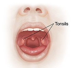 Tonsils