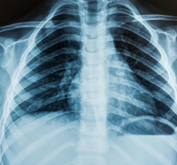 Xray image